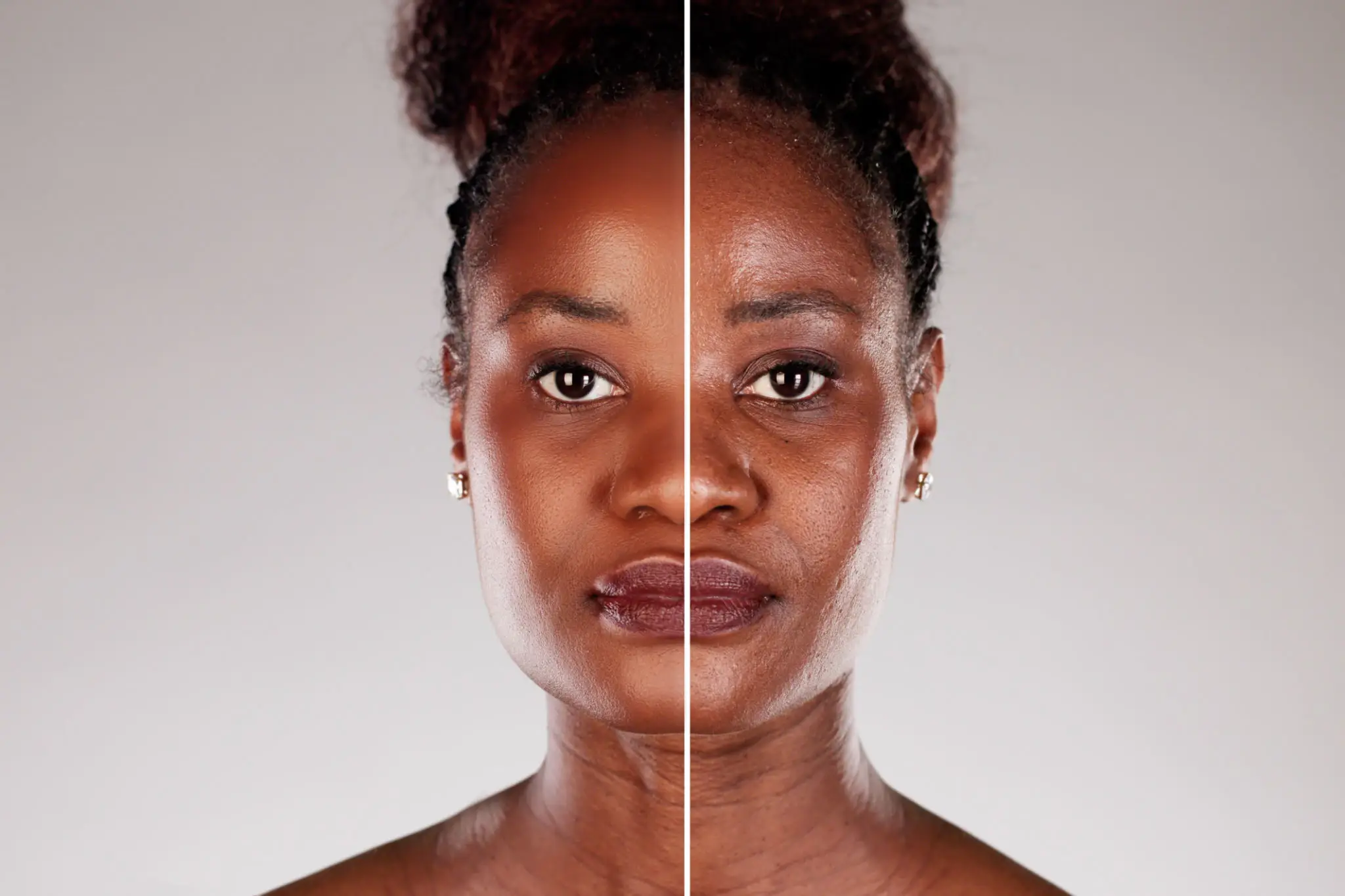 Split image showing a woman with clear skin on one side and blemished skin on the other.
