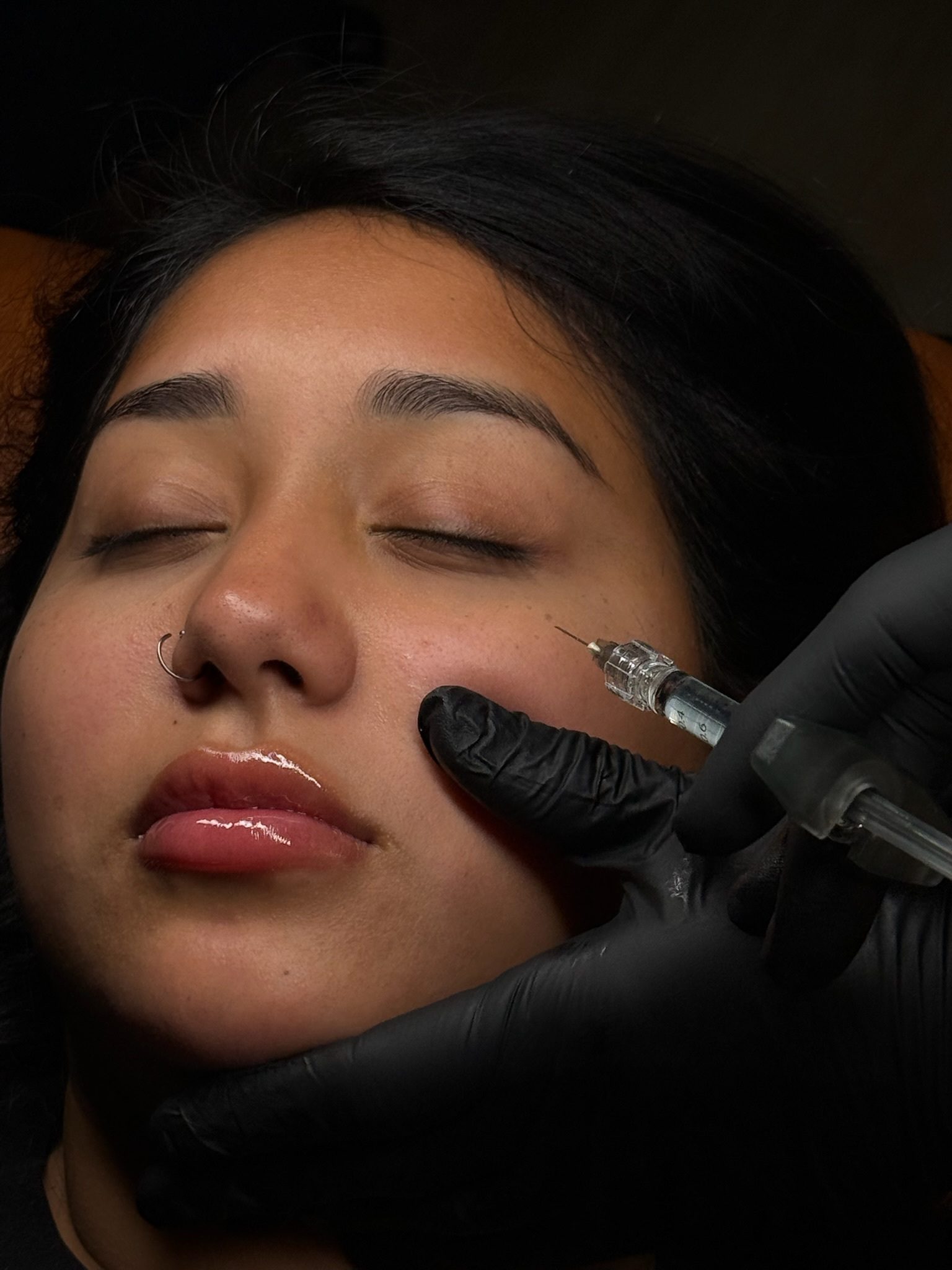 Close-up of a woman receiving a cosmetic injection in her face.